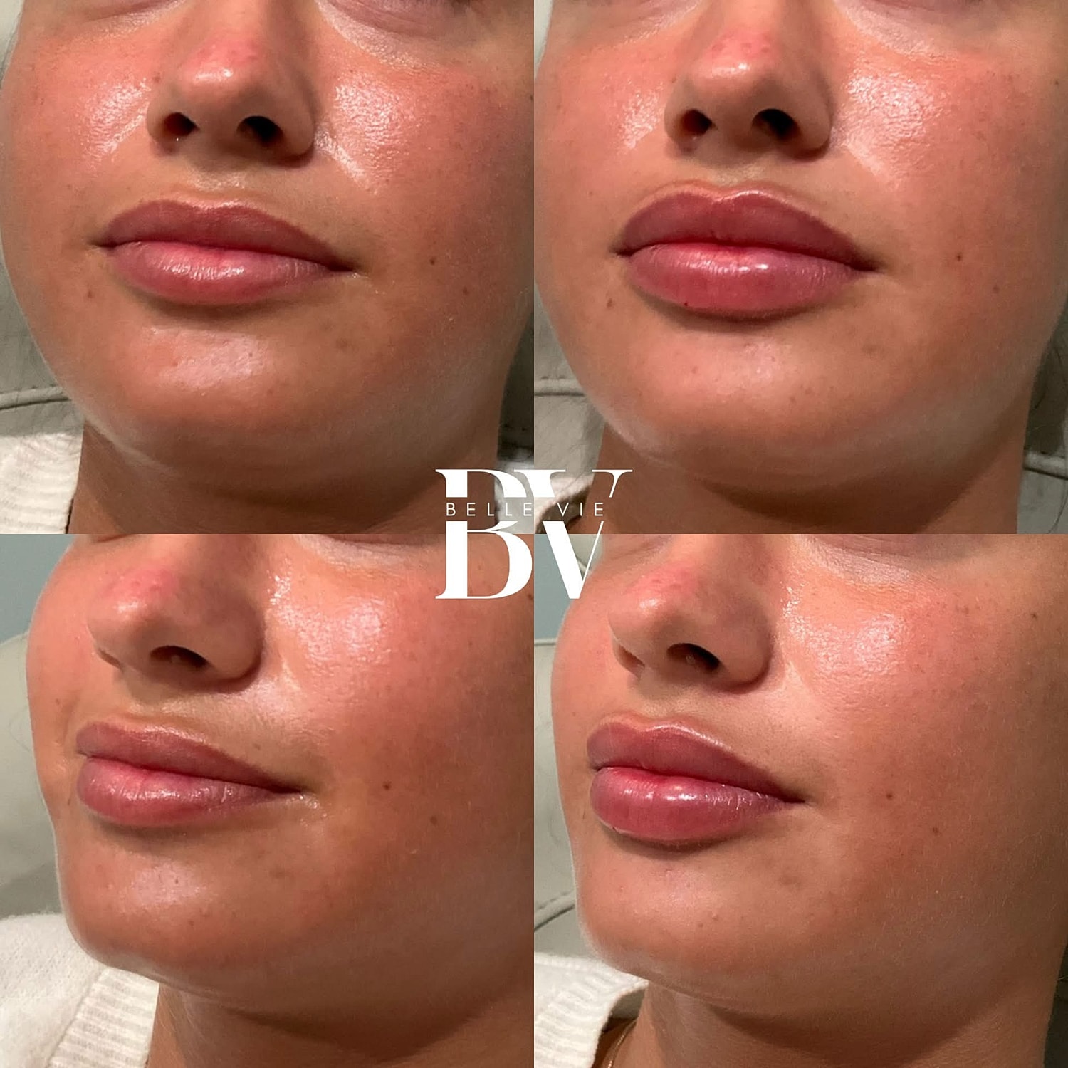 Close-up of glossy lips and smooth skin.