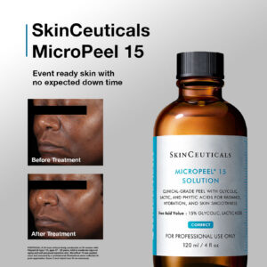 Chemical Peel, SkinCeuticals MicroPeel 15